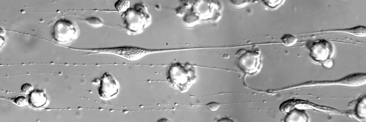 <multi>[fr]Mégacaryocytes dans un circuit microfluidique [en]Megakaryocytes in a microfluidic channel</multi>
